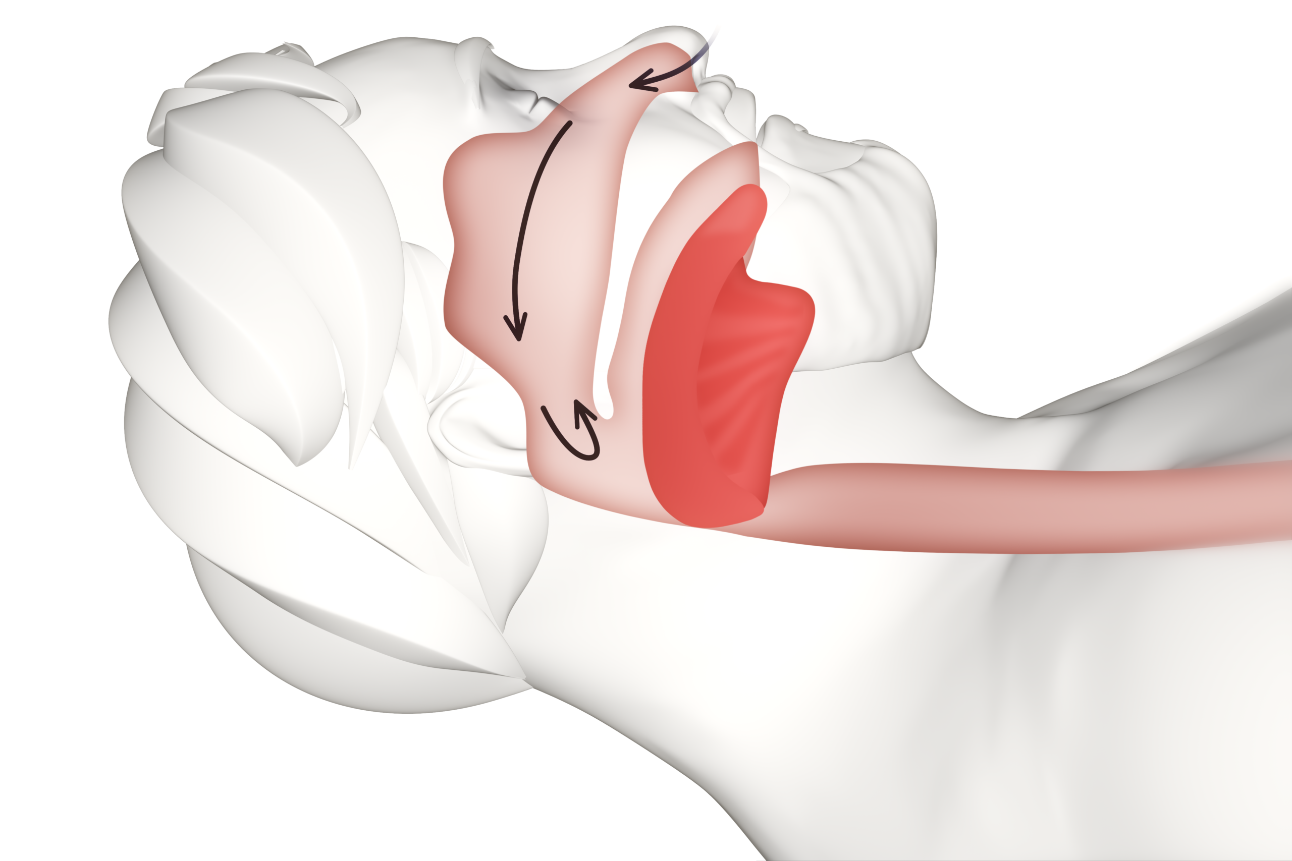 An illustration showing a sleep apnea event occuring.