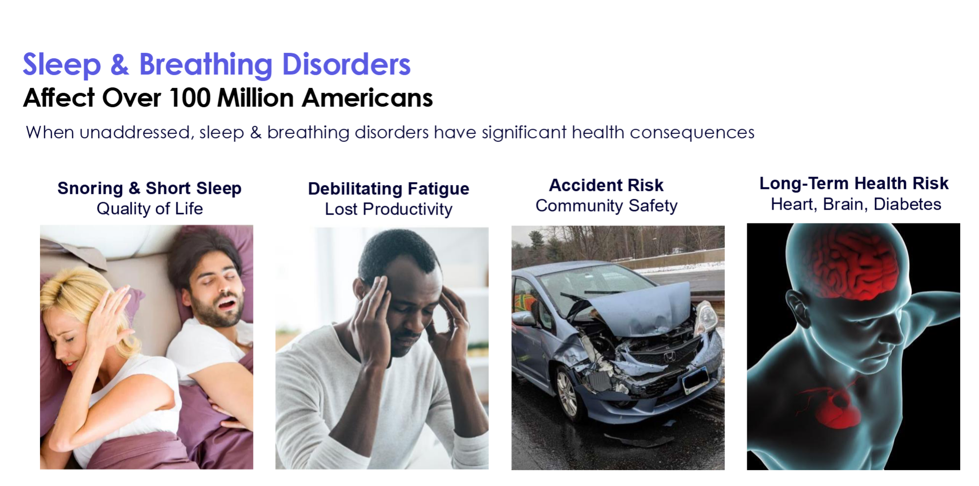 Four cards illustrating the risks of sleep apnea: quality of life, lost productivity, community safety and risks to heart brain and of diabetes.