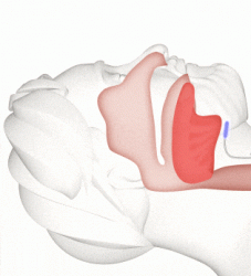 An animated illustration shows how breathing is clear with Inspire.
